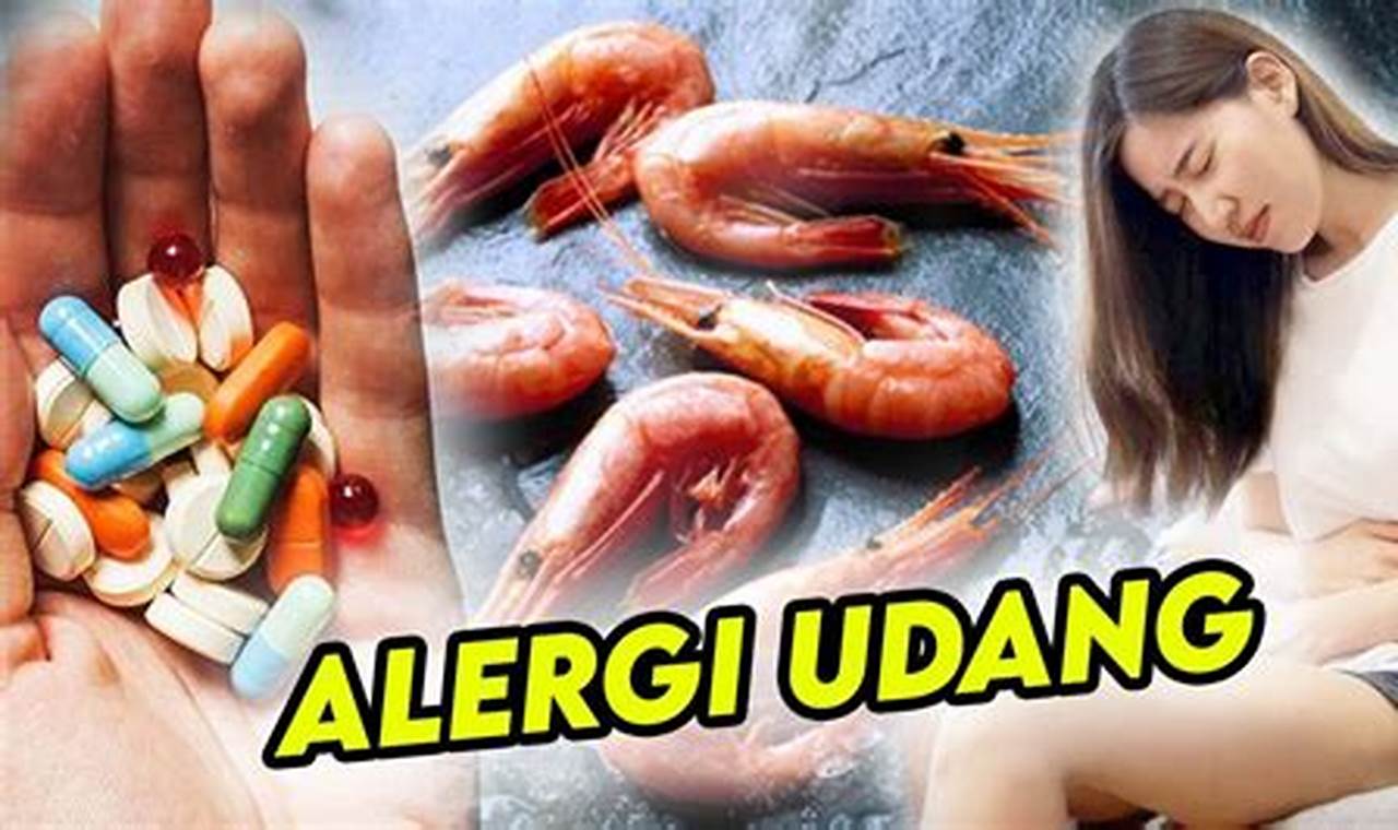 Cara Mengatasi Alergi Udang